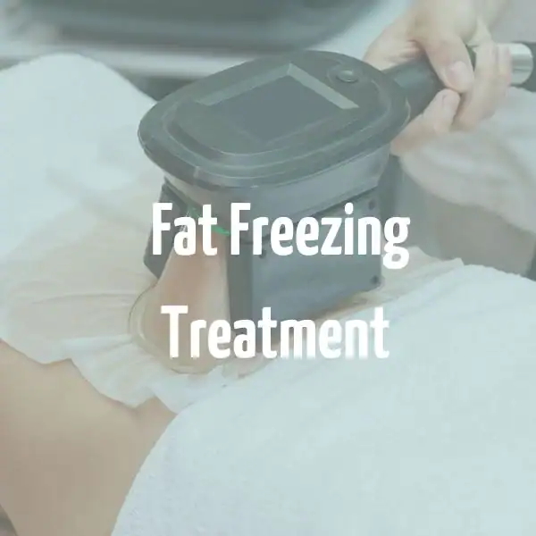fat freezing treatment Godalming