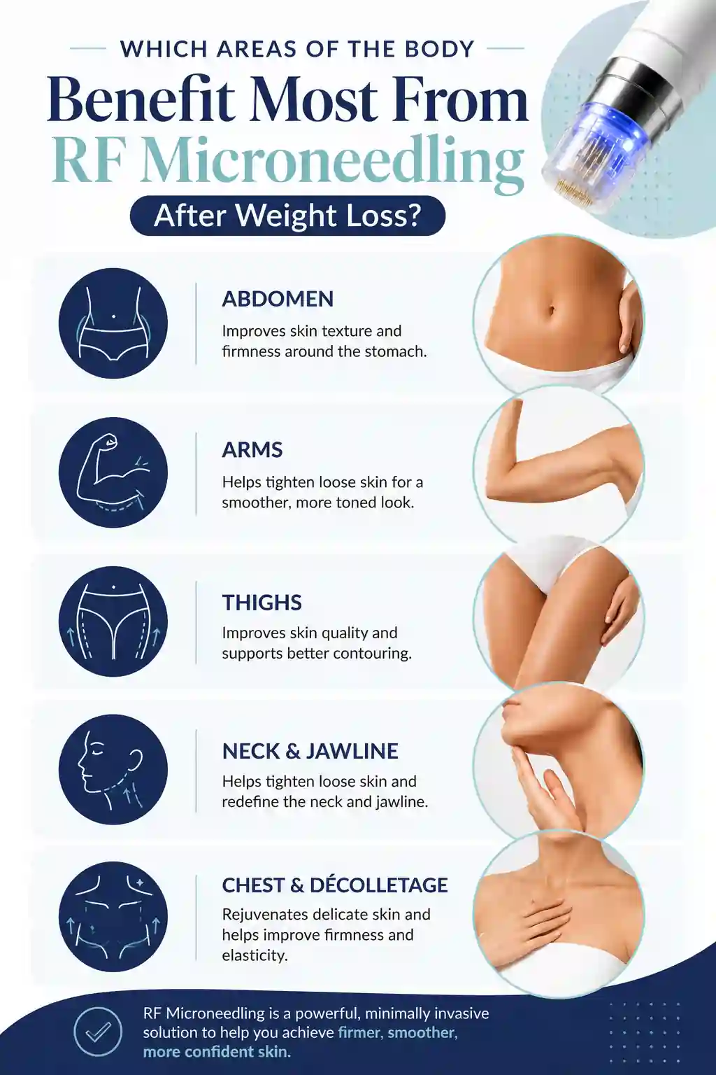 Which Areas of the Body Benefit Most From RF Microneedling After Weight Loss Godalming